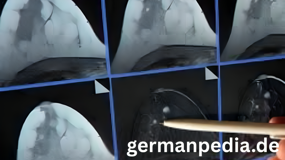 außen sichtbar wie sieht brustkrebs aus bilder